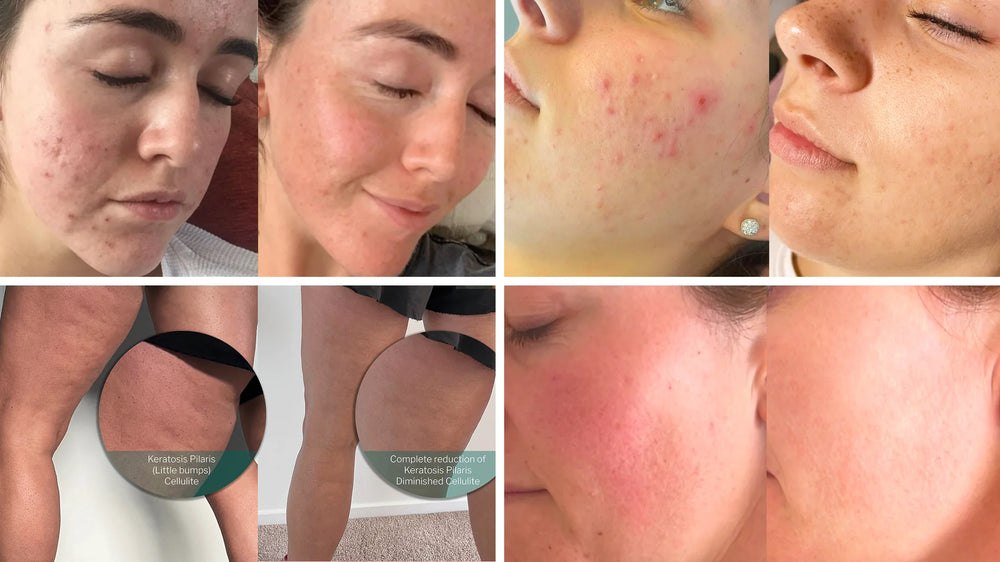Juvenate Skincare Limited