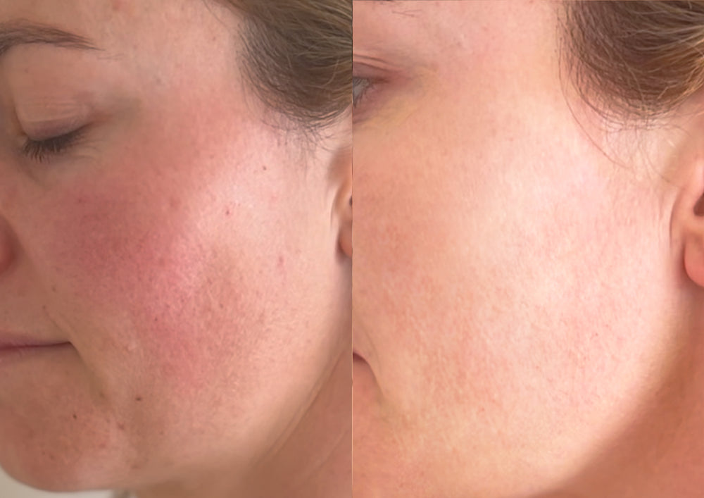Juvenate Skincare Limited