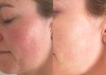 Juvenate Skincare Limited